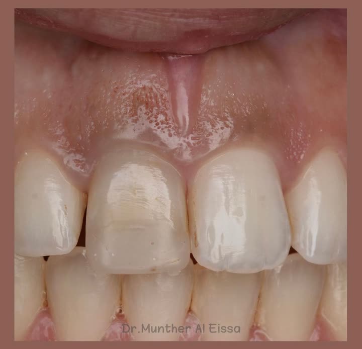 محتوى سناب شات لـ Dr Munther ✨🦷