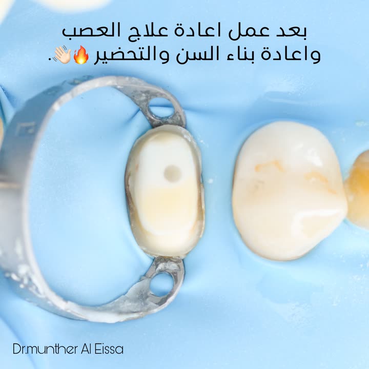 محتوى سناب شات لـ Dr Munther ✨🦷