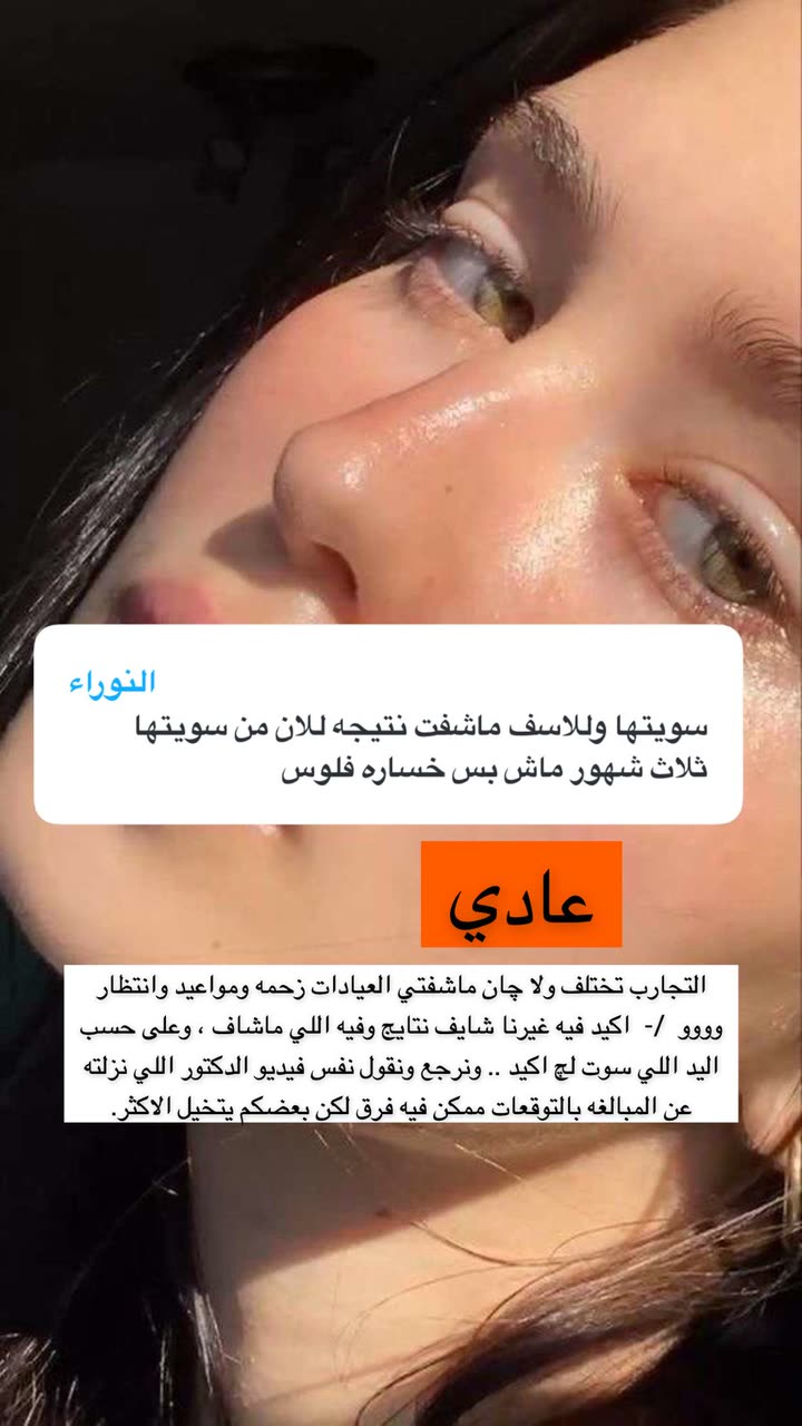 محتوى سناب شات لـ Abrar Jassim