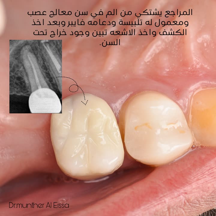 محتوى سناب شات لـ Dr Munther ✨🦷