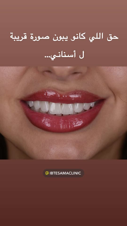 توما النعيمي Spotlight #fapchati6