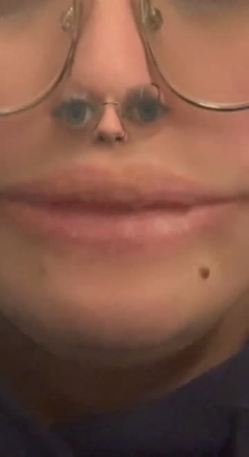 Preview for a Spotlight video that uses the Nostrils Eyes Lens