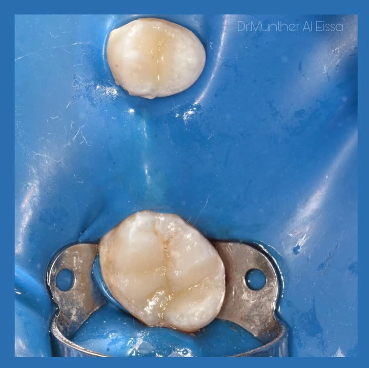 محتوى سناب شات لـ Dr Munther ✨🦷