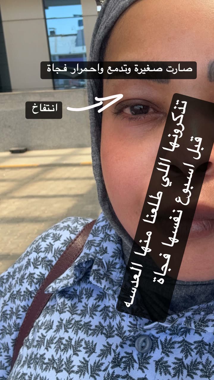 قصة سناب شات للحساب a.almburak76 رقم 376