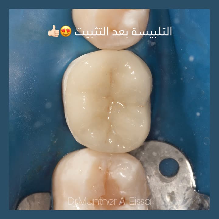 محتوى سناب شات لـ Dr Munther ✨🦷