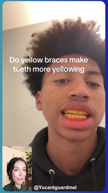 Say Cheese