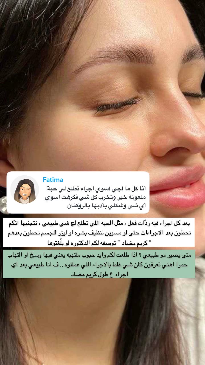 محتوى سناب شات لـ Abrar Jassim