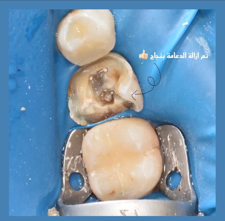 محتوى سناب شات لـ Dr Munther ✨🦷