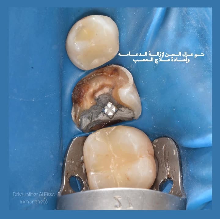 محتوى سناب شات لـ Dr Munther ✨🦷