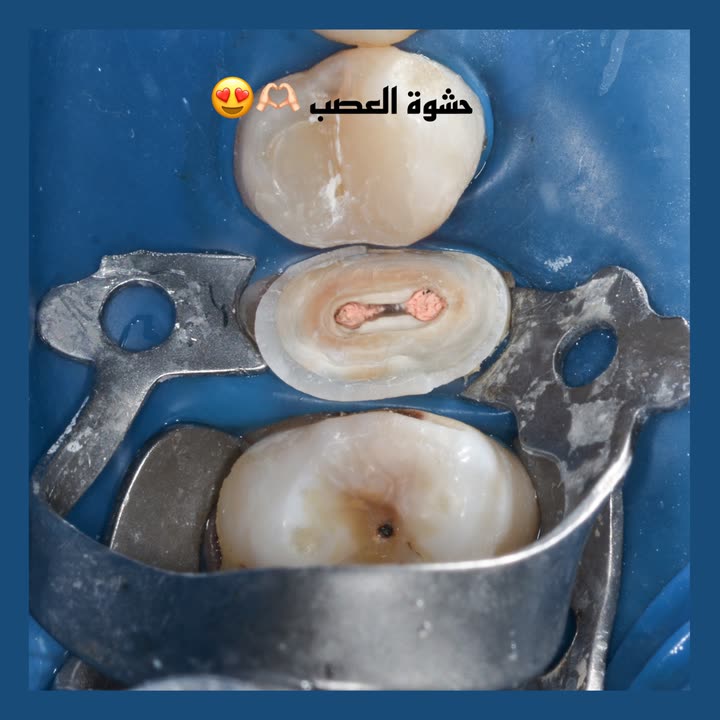 محتوى سناب شات لـ Dr Munther ✨🦷