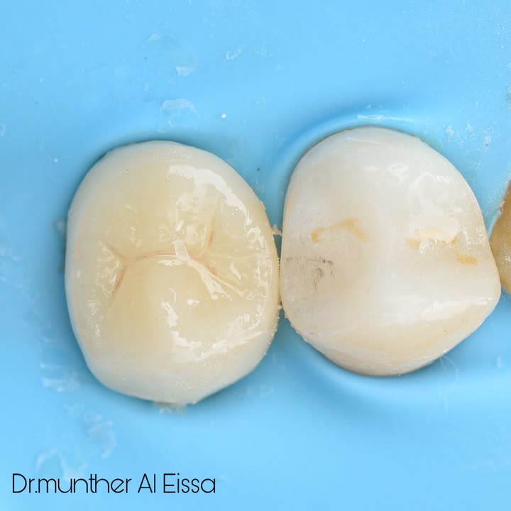 محتوى سناب شات لـ Dr Munther ✨🦷