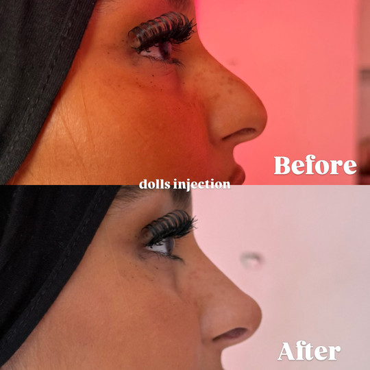 dolls_injection