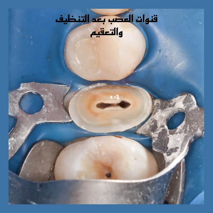 محتوى سناب شات لـ Dr Munther ✨🦷