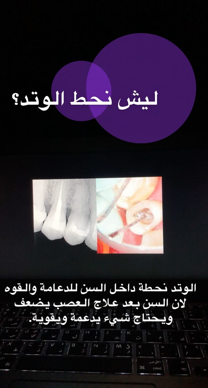 محتوى سناب شات لـ د. ساره الفدا