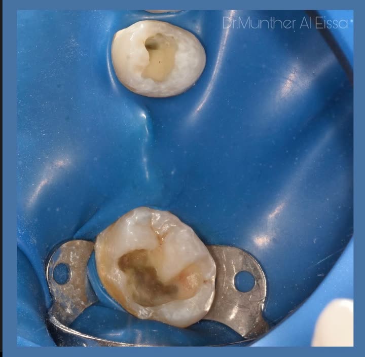 محتوى سناب شات لـ Dr Munther ✨🦷