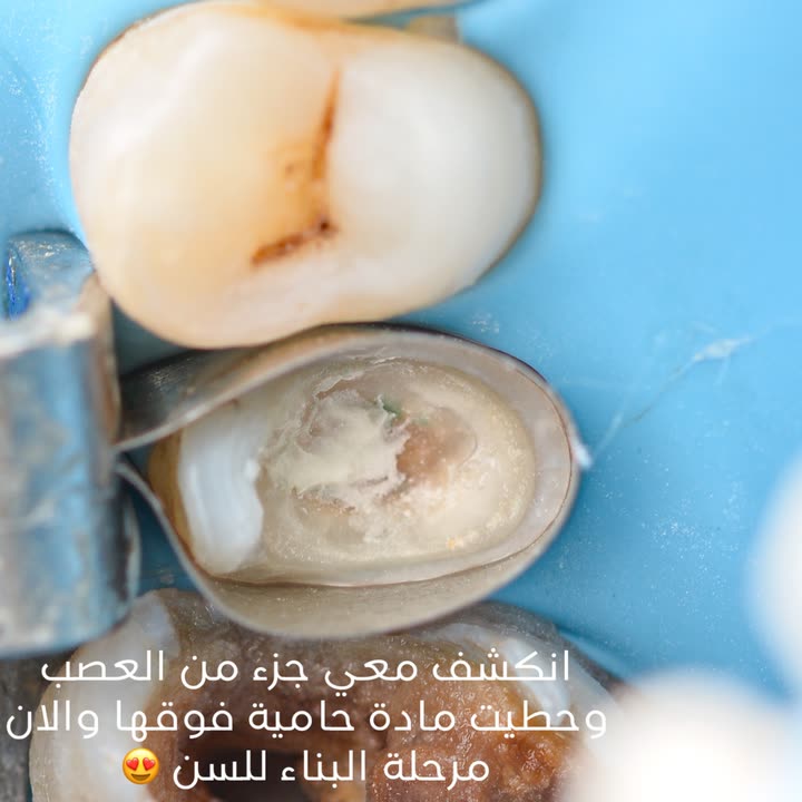 محتوى سناب شات لـ Dr Munther ✨🦷