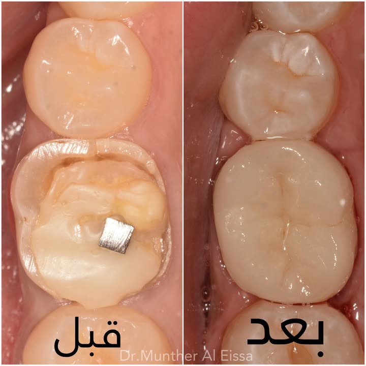محتوى سناب شات لـ Dr Munther ✨🦷
