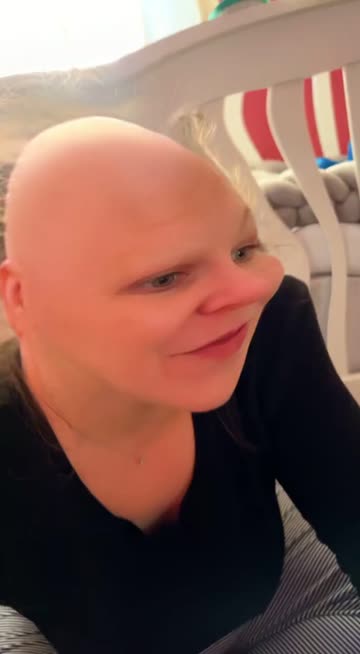 Preview for a Spotlight video that uses the be bald Lens