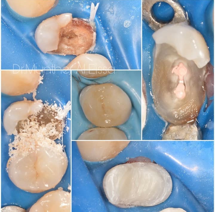 محتوى سناب شات لـ Dr Munther ✨🦷