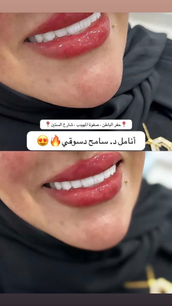 محتوى سناب شات لـ عاجل الحفر