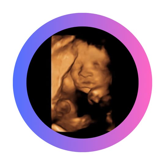 Keepsake Imaging Studio (ultrasoundwyo) Snapchat Stories, Spotlight