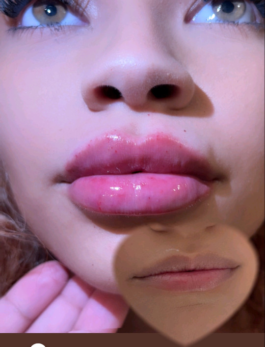 lilybad617