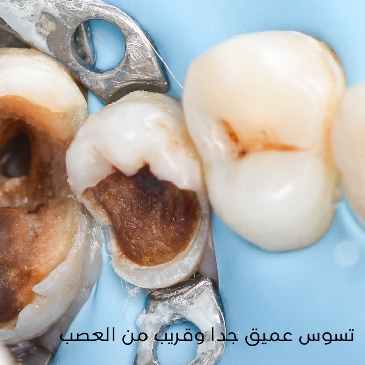 محتوى سناب شات لـ Dr Munther ✨🦷