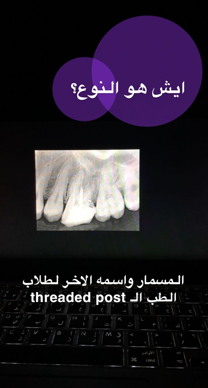 محتوى سناب شات لـ د. ساره الفدا