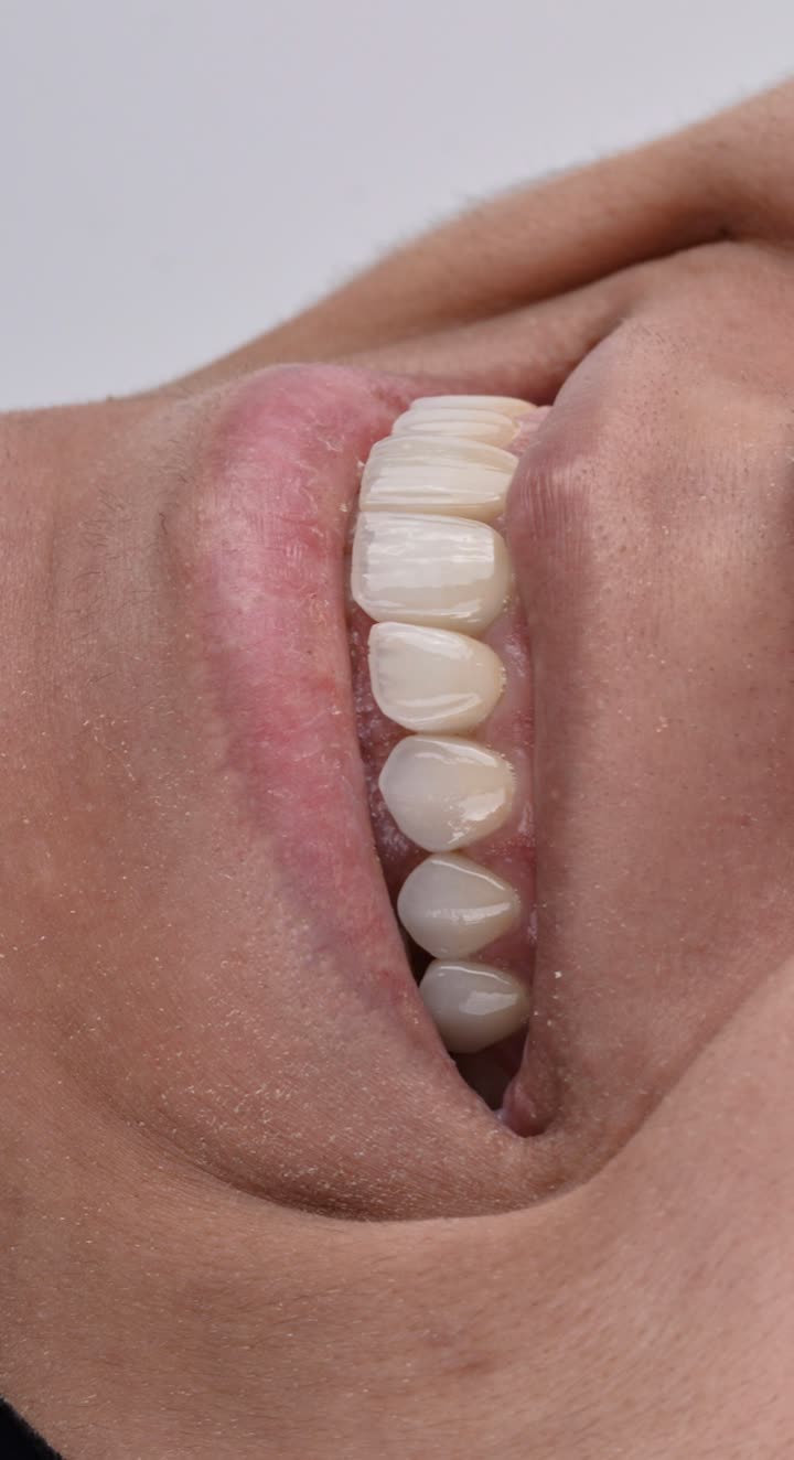 محتوى سناب شات لـ Dr Munther ✨🦷