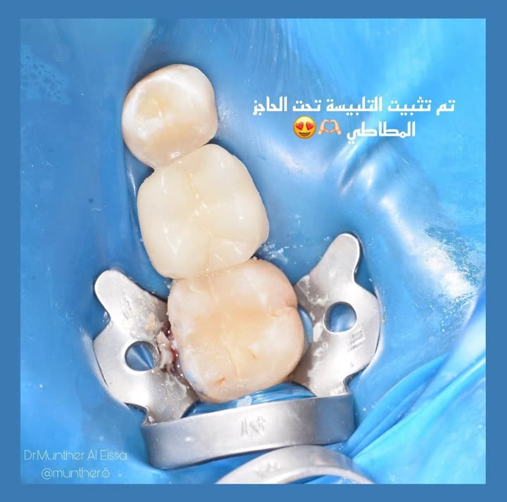 محتوى سناب شات لـ Dr Munther ✨🦷