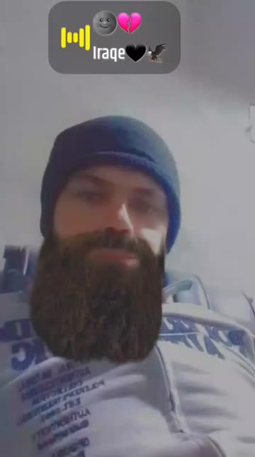 Preview for a Spotlight video that uses the Airy Beard Lens