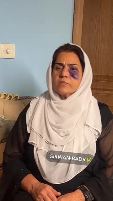 Preview for a Spotlight video that uses the black eye Lens