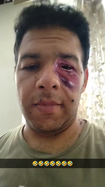 Preview for a Spotlight video that uses the black eye Lens