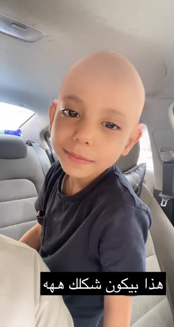 Preview for a Spotlight video that uses the Bald Lens