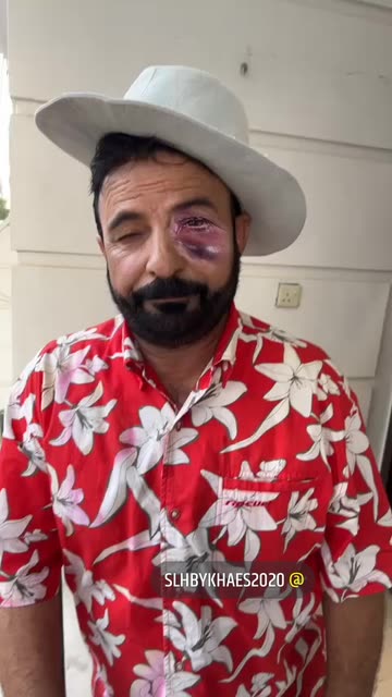 Preview for a Spotlight video that uses the black eye Lens