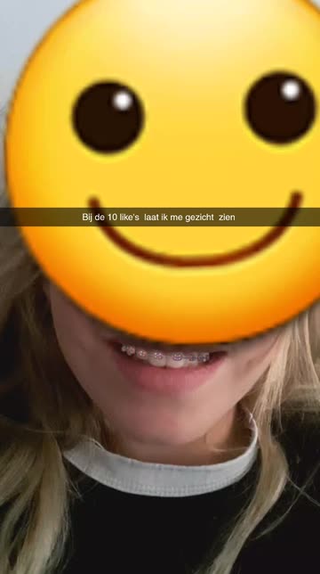 Preview for a Spotlight video that uses the Braces Red Lens